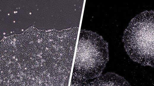 Induced pluripotent stem cells (iPSCs) from the SCTi003-A line, cultured using STEMmatrix™ BME and mTeSR™ Plus.