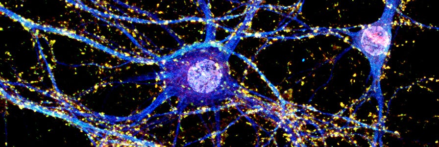 Image result for neuronal activity