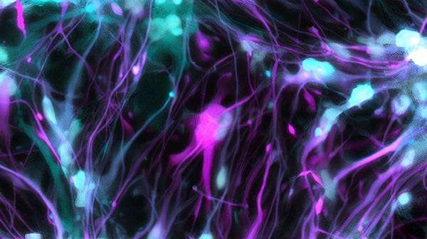 Image of hPSC-Derived Astrocytes from the SCTi003-A cell line.