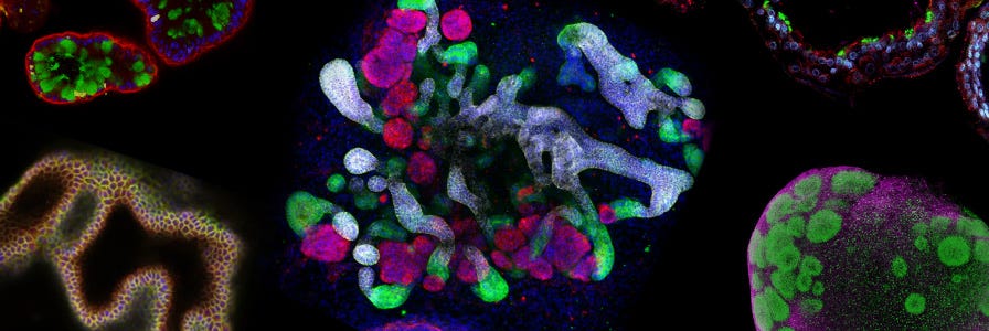 Collage of microscopy images of organoids