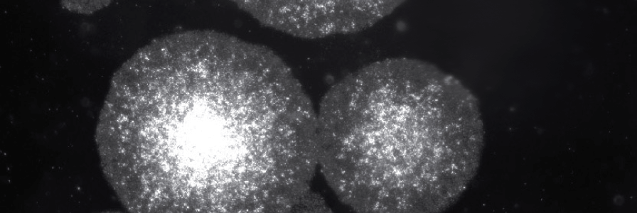 Light microscopy of urine-derived epithelial cells in stages of reprogramming