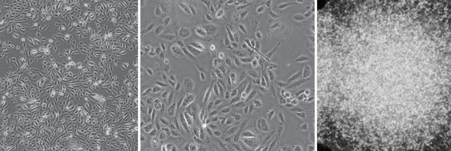 Light microscopy of urine-derived epithelial cells in stages of reprogramming