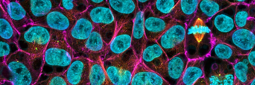 Fluorescent microscopy of human pluripotent stem cell colony