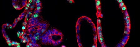 Intestinal organoids