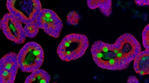 Intestinal Organoids