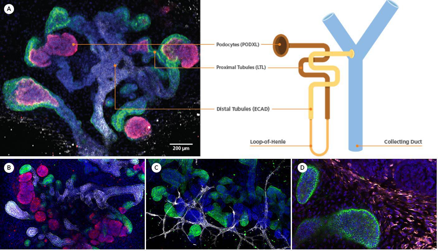 Nephron-like segmentation in kidney organoid cultures