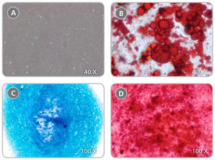 Human ES- and iPS-derived MPCs Can Be Further Differentiated Into Adipogenic, Chondrogenic and Osteogenic Lineages