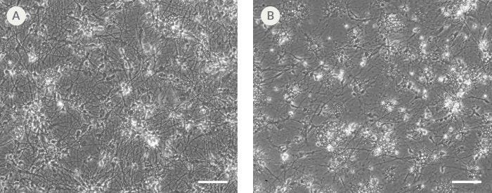 hPSC-Derived Neurons Generated in BrainPhys™ Neuronal Medium and NeuroCult™ SM1 and N2 Supplements are Healthy and Morphologically Normal