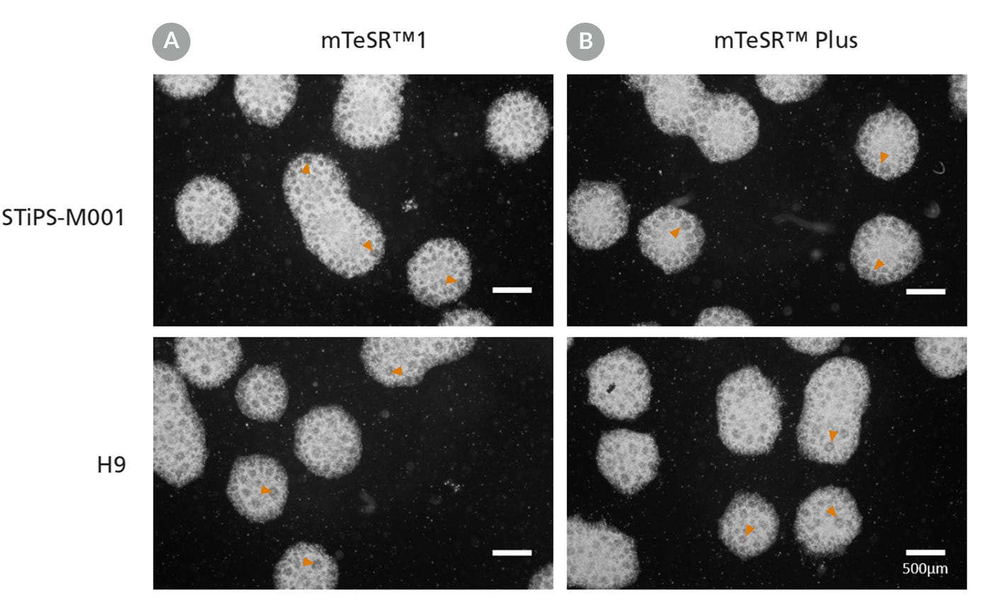 Cell morphology images of neural progenitor cells maintained in mTeSR™1 or mTeSR™ Plus. Arrowheads point to clearly displayed neural rosettes after replating embryoid bodies.