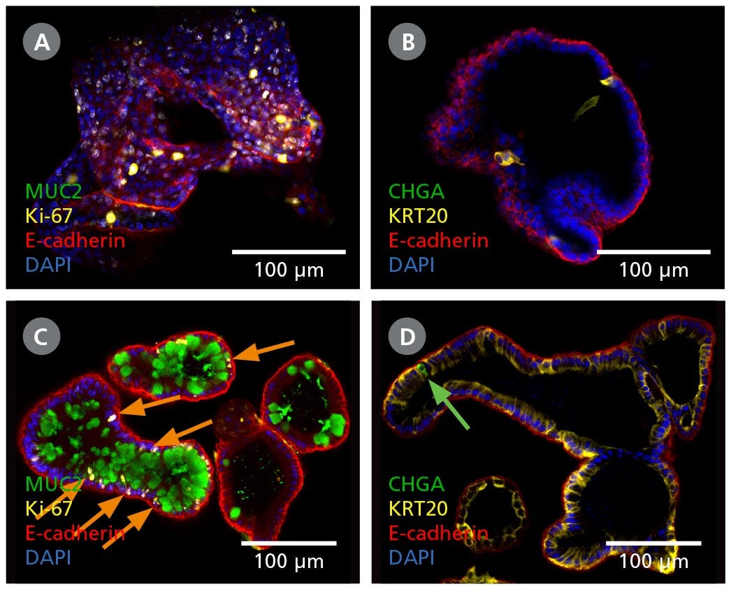 Intestinal Organoids Contain a Higher Proportion of Mature Cell Types Following Differentiation in IntestiCult™ ODM