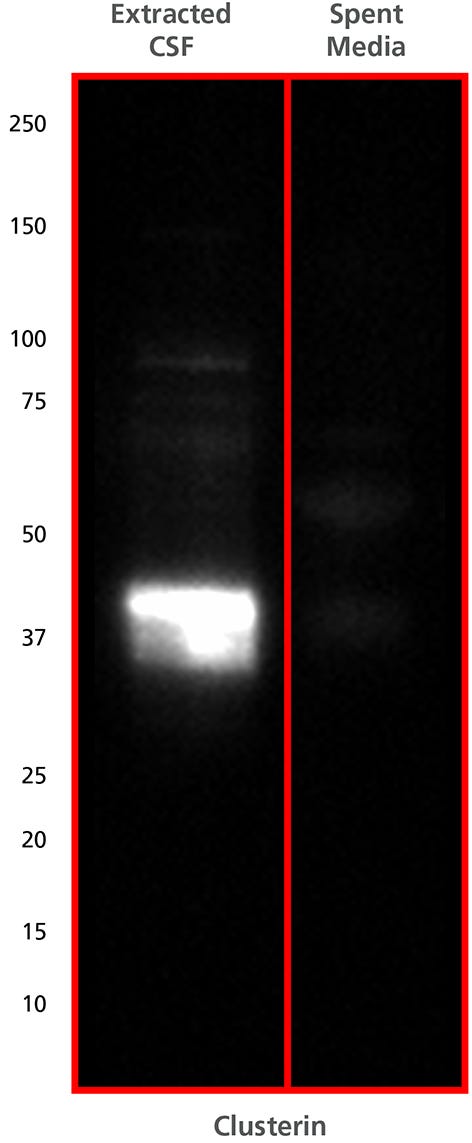 Western blot with 2 columns showing a band in extracted CSF between the 37 and 50 kDa molecular weight markers, but not in spent culture media