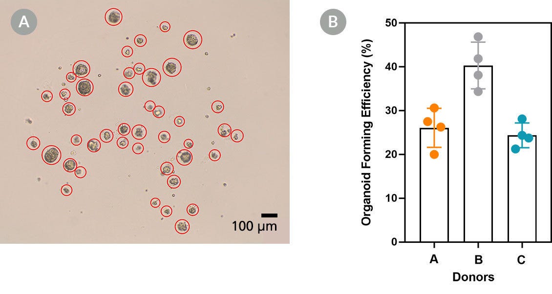 Brightfield image of alveolar organoids and a bar graph of organoid forming efficiencies of ATII organoid cultures.