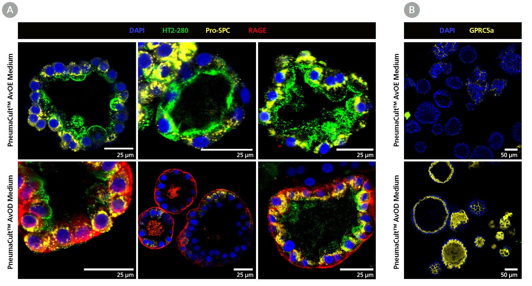 Immunostained alveolar organoids showing expression of ATI and ATII markers.