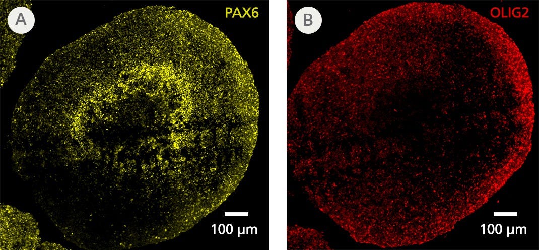 Spinal cord organoids generated with the STEMdiff Spinal Cord Organoid Kit expressing expected PAX6 and OLIG2 progenitor markers at Day 19