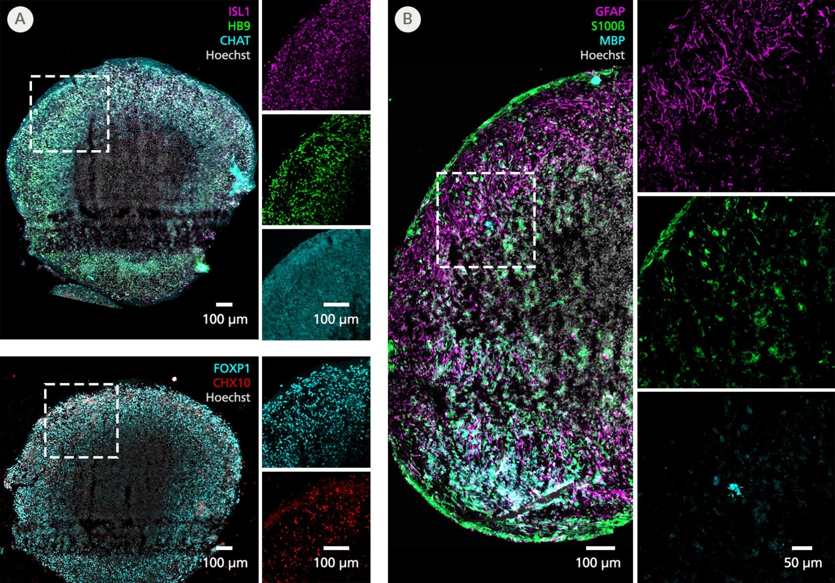 Spinal cord organoids generated with the STEMdiff Spinal Cord Organoid Kit expressing expected motor neuron and glutamatergic interneuron markers at Day 30 as well as astrocyte and oligodendrocyte markers at Day 75.