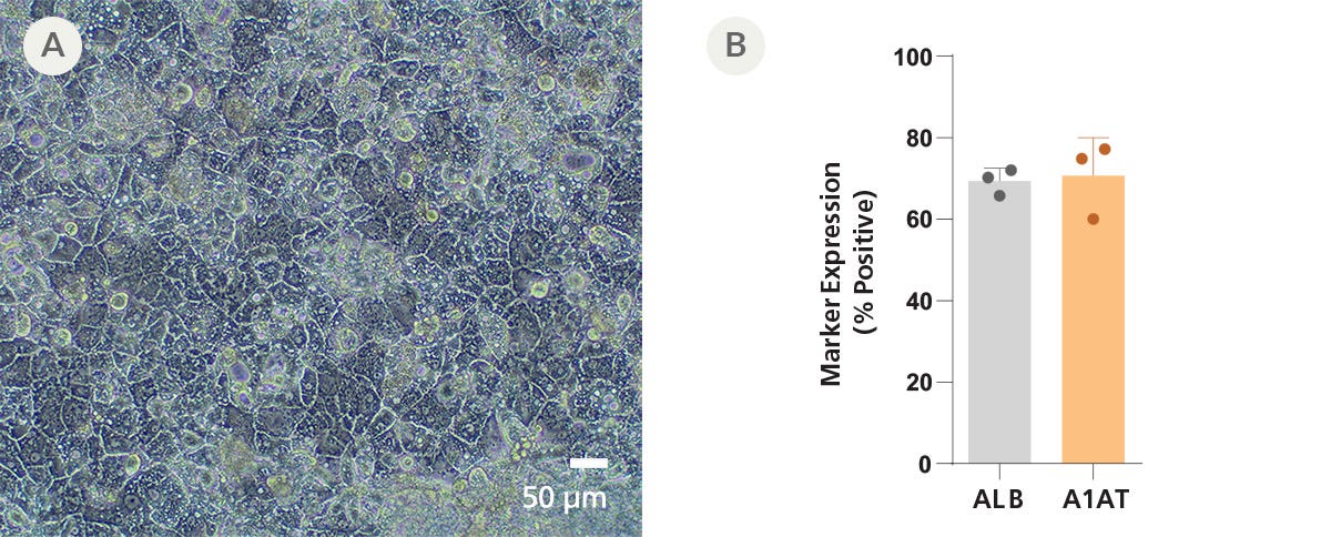 Microscopy image of Day 21 hepatocyte-like cells and quantification of hepatic gene expression markers ALB and A1AT