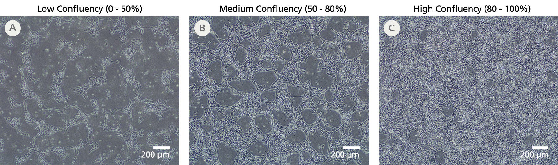 Microscopy images of iPSCdirect cells at low, medium, and high confluency after 24 hours