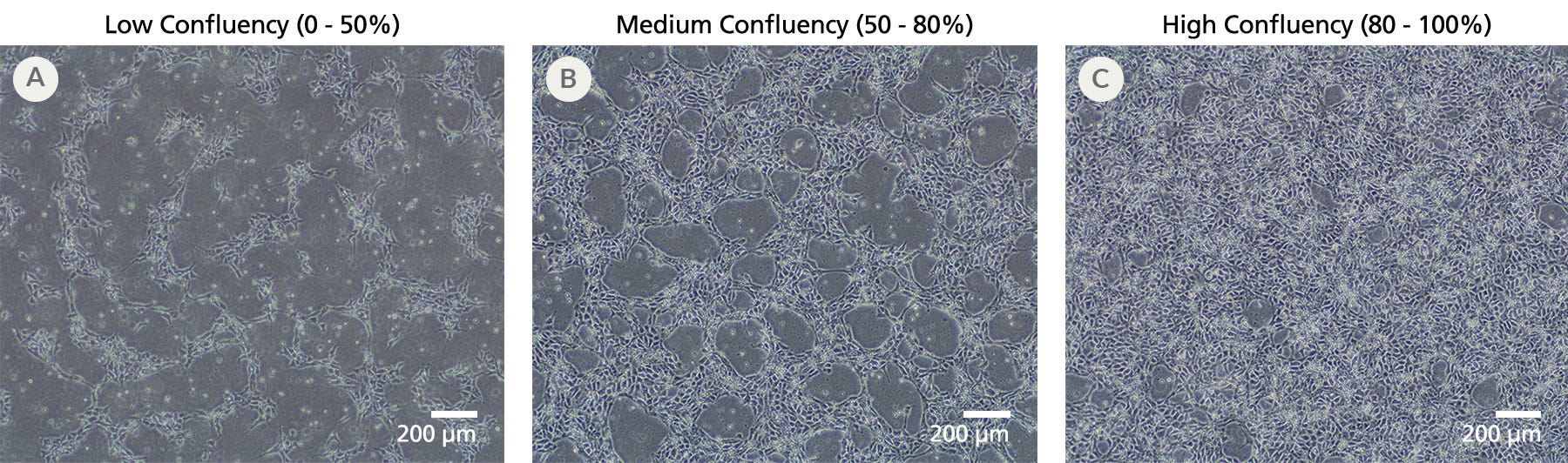 Microscopy images of iPSCdirect cells at low, medium, and high confluency after 24 hours