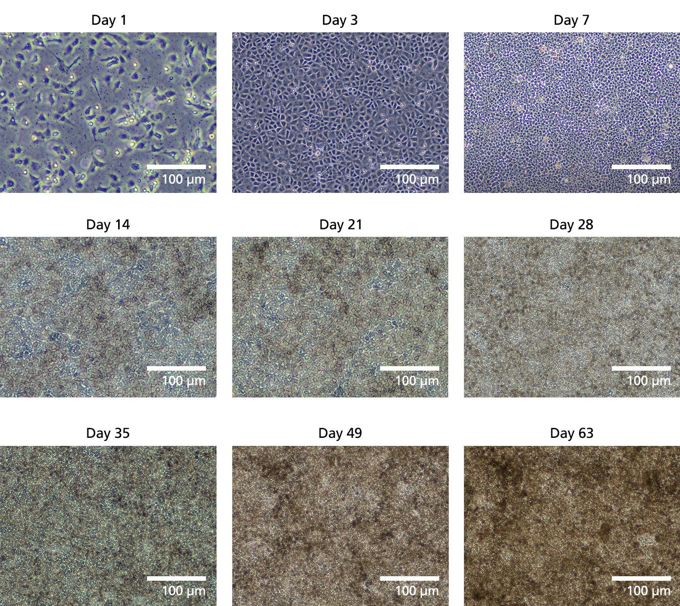 Human iPSC-Derived Retinal Pigment Epithelial Cells Show Characteristic RPE Morphology
