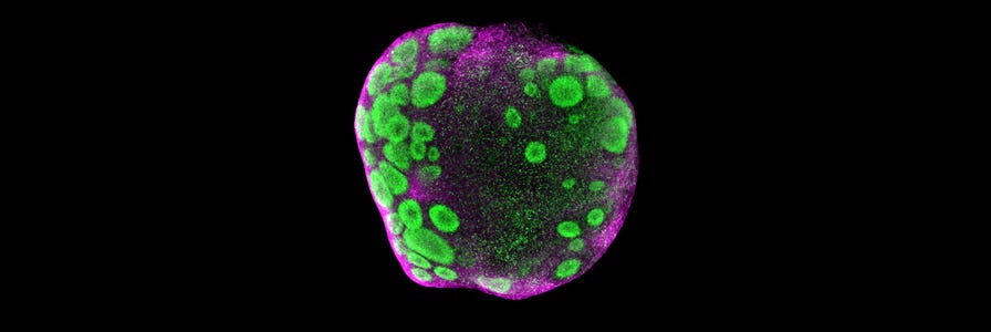 Image of a neural organoid