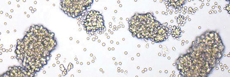 Image of CAR T cells in culture.