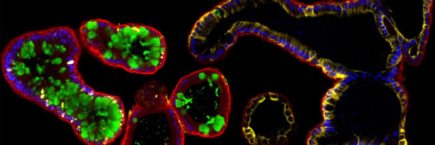 Learn more about intestinal organoids with this informative mini-review.