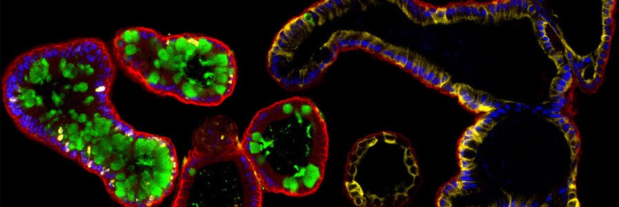 Microscopy image of intestinal organoids