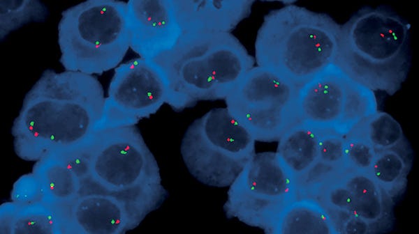 FISH probes bound to CD138+ cells