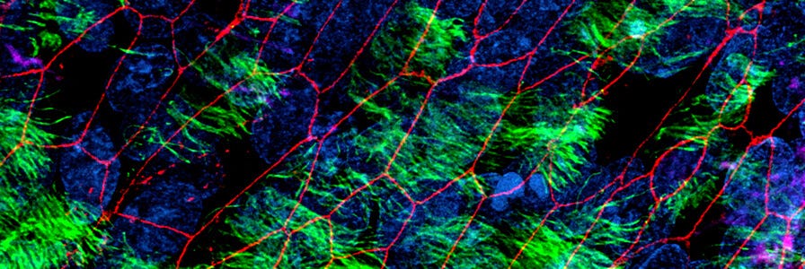 Immunostained human airway epithelial cells