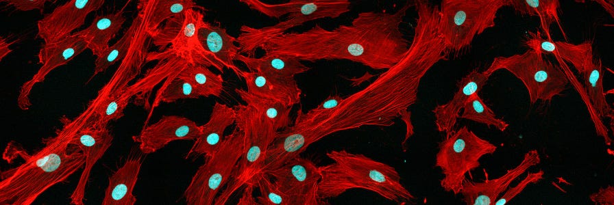 Mesenchymal Stromal Cells