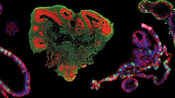 Find additional organoid webinars, technical resources, researcher profiles, and more.