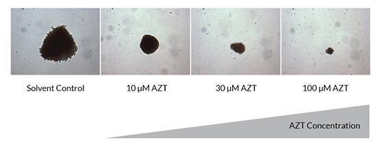 Photos of anti-proliferative effect of AZT on erythroid (BFU-E) colony size.