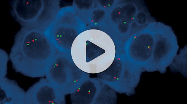 Webinar: How to Enhance the Sensitivity of Downstream Assays for CLL Research