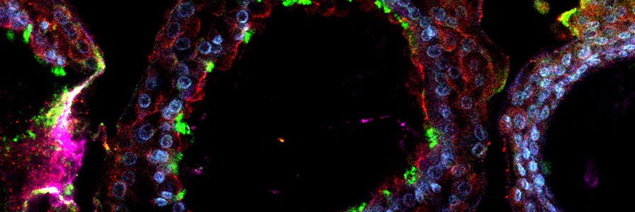 Airway organoids